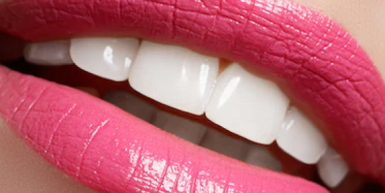 pink lips with professionally whitened teeth