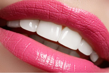 pink lips with professionally whitened teeth