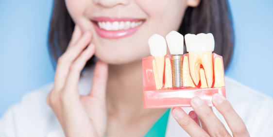 Dental implants Health Hub Fortitude Valley