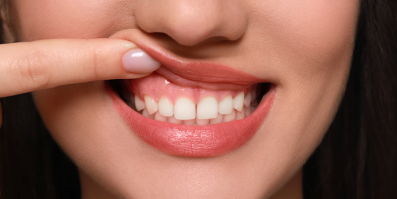 Dental Health Hub Fortitude Valley